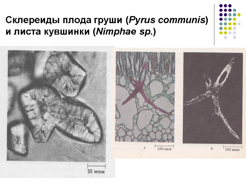 Склереиды плода груши (Pyrus communis)  и листа кувшинки (Nimphae sp.)